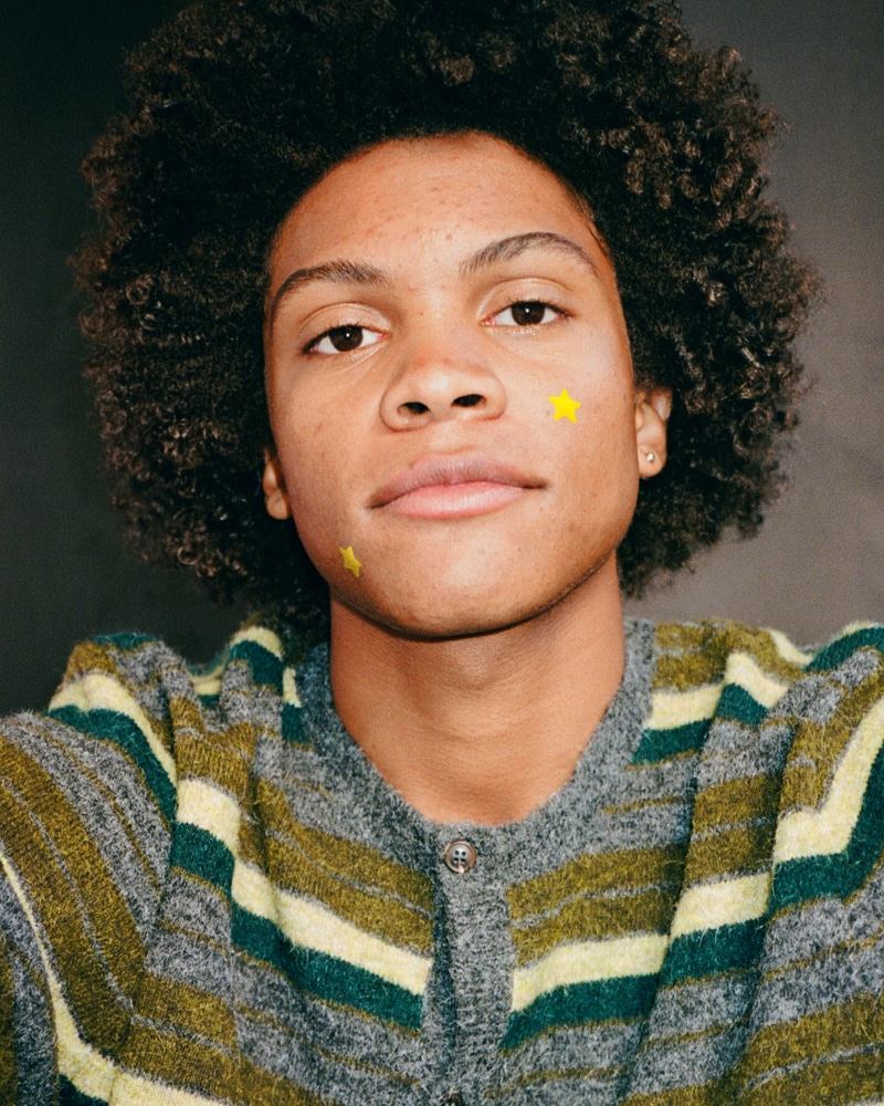 Starface Hydro-Star Pimple Patches + Big Yellow Compact
