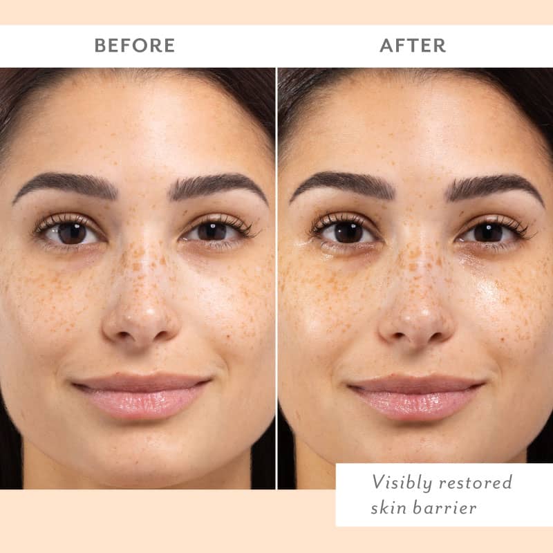 Skin Remedy Barrier-Boosting Sheet Mask 4-Pack