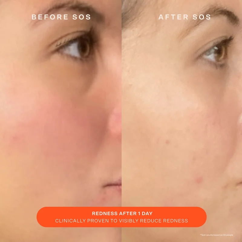 SOS Recovery Cream
