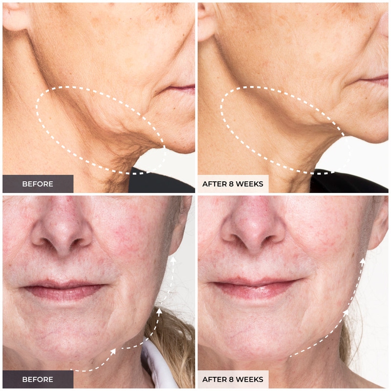 Medi Lift Essential Face Mask