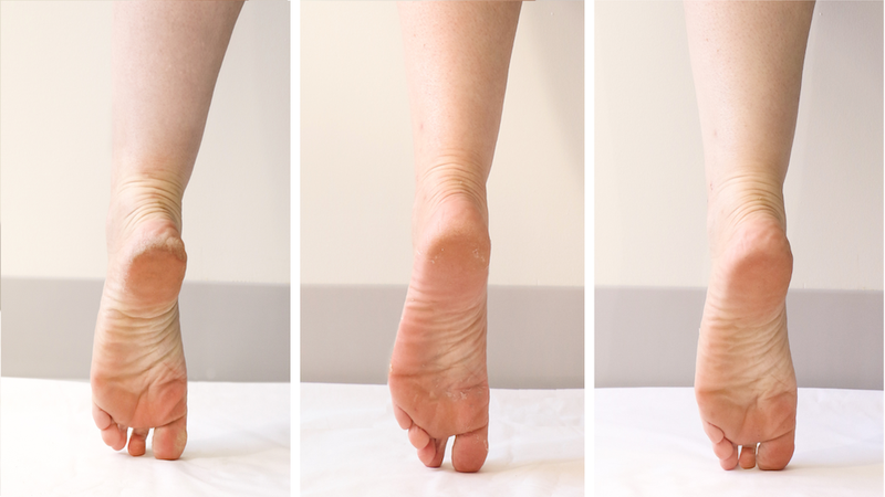 PoshPeel Pedi Cure